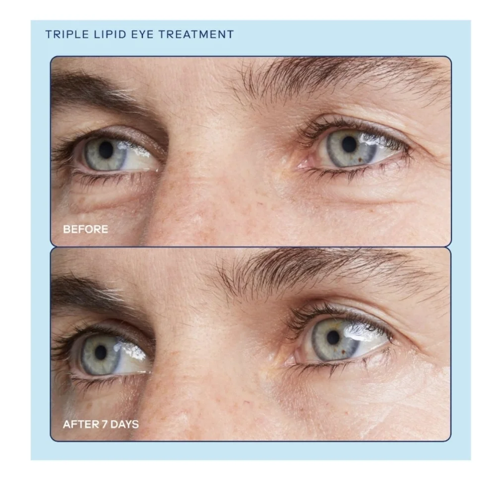Skinfix barrier+ Triple Lipid Brightening Eye Cream